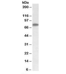 Anti-Arginyl-tRNA synthetase
