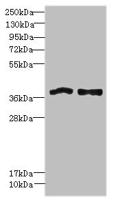 Anti-FPR1
