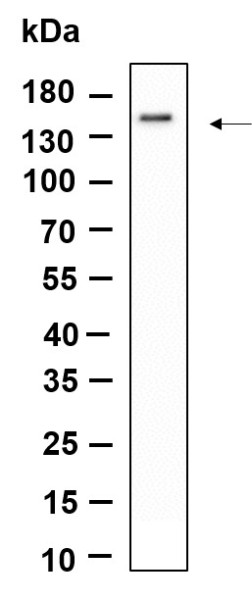 Anti-Recombinant SMC3, clone 9D9