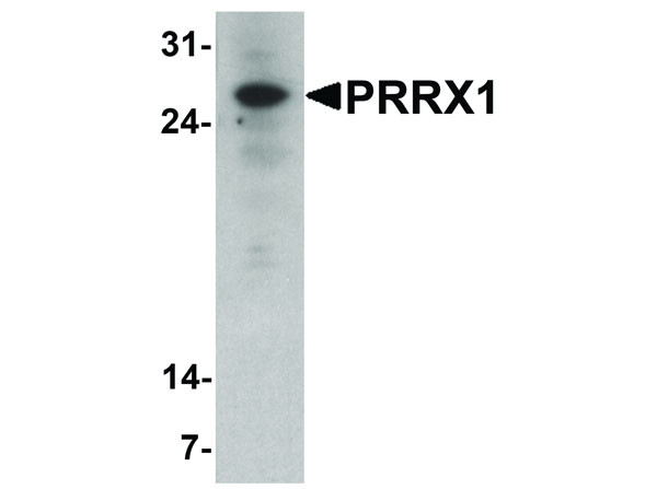 Anti-PRRX1