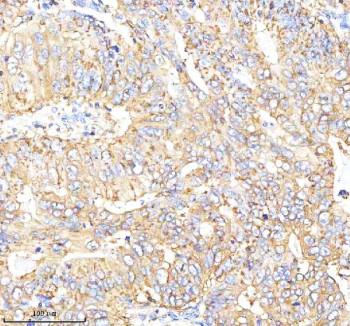 Anti-CGA / Choriogonadotropin alpha