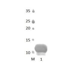 MAGI2_3 PDZ Domain