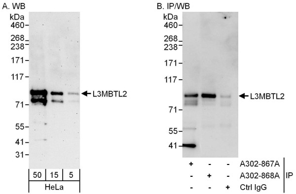Anti-L3MBTL2