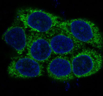Anti-Alpha Actin / ACTA2 / Smooth Muscle Actin, clone CAD-1