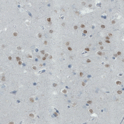 Anti-SATB2, clone CL0321