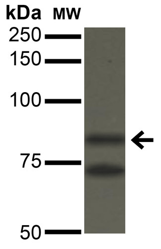 Anti-Ataxin 1, clone S76-8