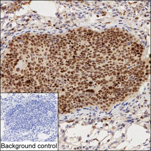 Anti-IFRD1