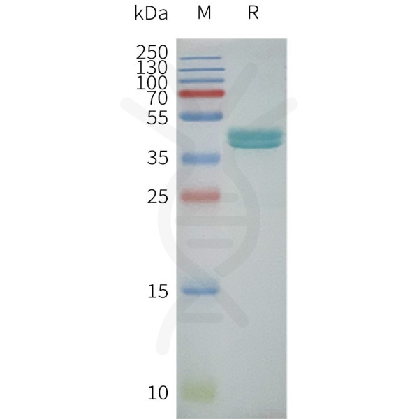 Human GPRC5C-Strep full length protein-synthetic nanodisc