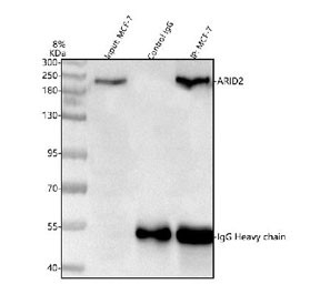 Anti-ARID2 / AT-rich interactive domain-containing protein 2