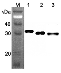 Anti-Ribosomal Protein S3 (human), clone RP159-1