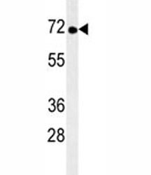Anti-TNK1, clone 170CT7.5.4