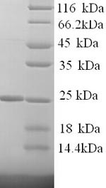 Kallikrein-7 (KLK7), partial, human, recombinant
