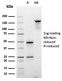 Anti-Cyclin E (G1/S-Phase Cyclin), clone CCNE1/2587