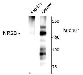 Anti-phospho-NMDA NR2B Subunit (Ser1166)