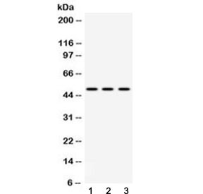 Anti-DR4 / Death Receptor 4