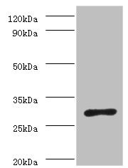 Anti-ureA