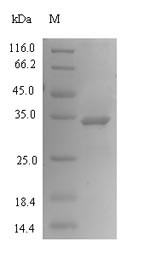Phosphoethanolamine/phosphocholine phosphatase (PHOSPHO1), human, recombinant