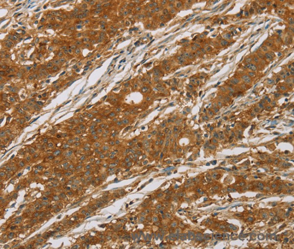 Anti-CYP27A1