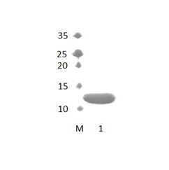 FRMPD3 PDZ Domain
