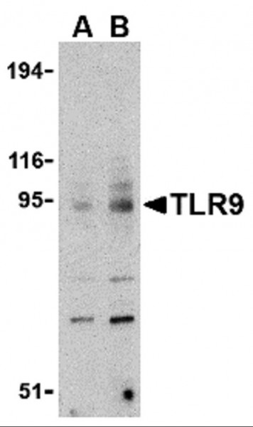 Anti-TLR9