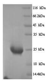 Butyrophilin subfamily 2 member A1 (BTN2A1), partial, human, recombinant