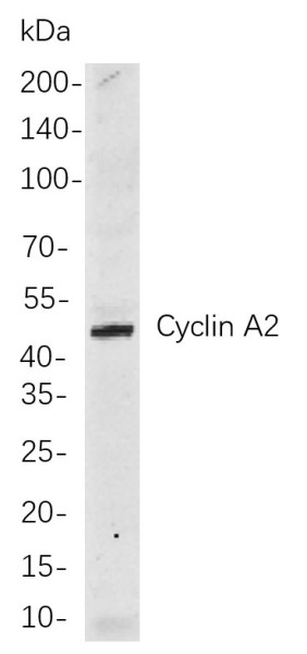 Anti-Recombinant Cyclin A2, clone 4F11