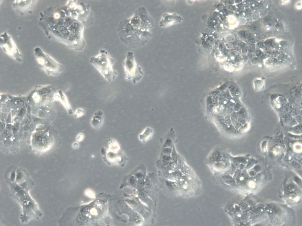 HROC284Met Cells