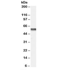 Anti-CACNB4