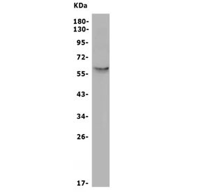 Anti-SLC2A10 / GLUT10