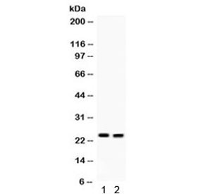 Anti-Lipocalin 2 / NGAL / LCN2