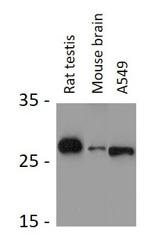 Anti-TRH / Thyrotropin Releasing Hormone