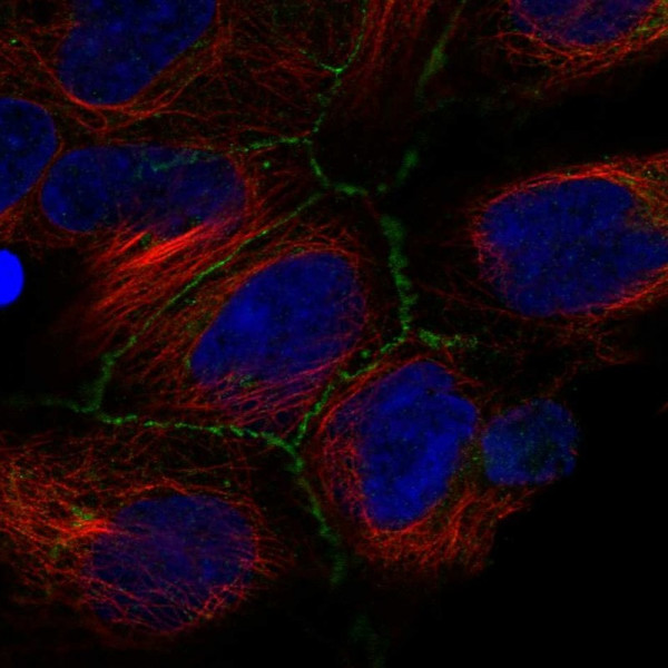 Anti-IREB2