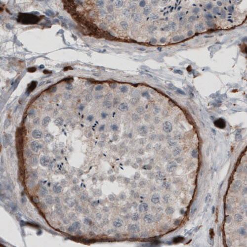 Anti-LAMA1, clone CL2968