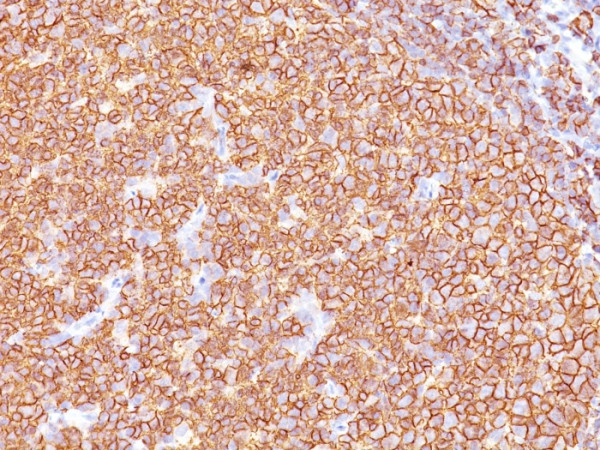 Anti-CD20 / MS4A1 (B-Cell Marker), clone SPM618
