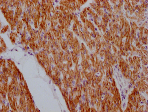 Anti-DES Monoclonal