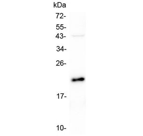 Anti-AES / Amino-terminal enhancer of split