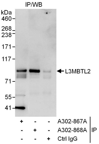 Anti-L3MBTL2