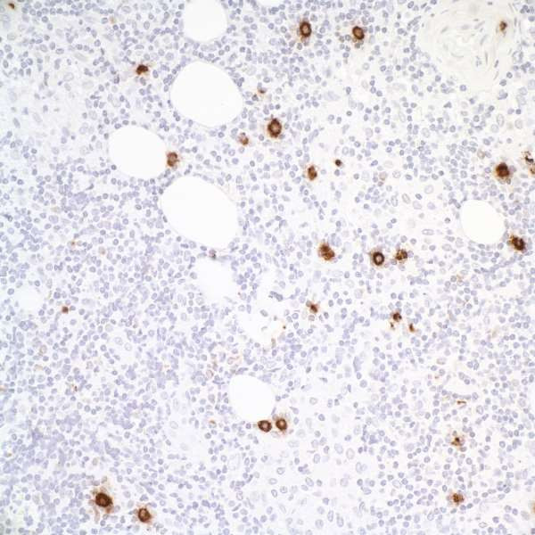 Anti-Granzyme B Recombinant Monoclonal