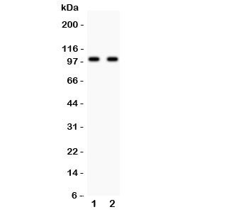 Anti-Glutamate receptor 3