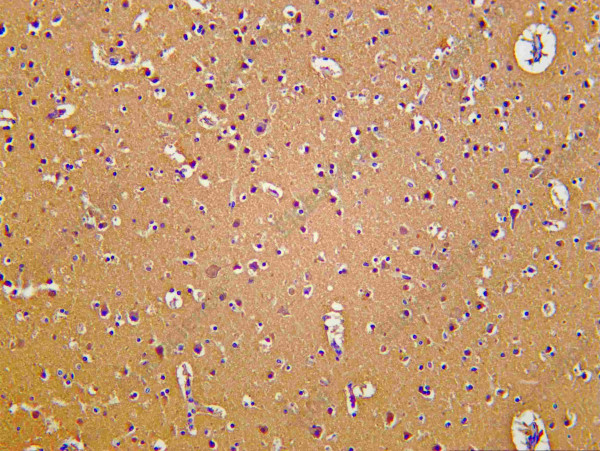 Anti-Recombinant TF, clone C112296