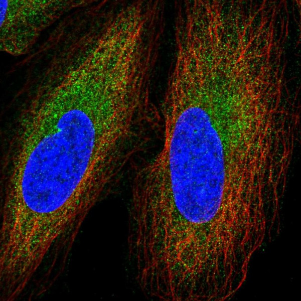 Anti-GGNBP2