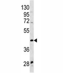 Anti-WNT9A