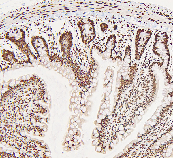 Anti-DDX5 / p68 RNA helicase