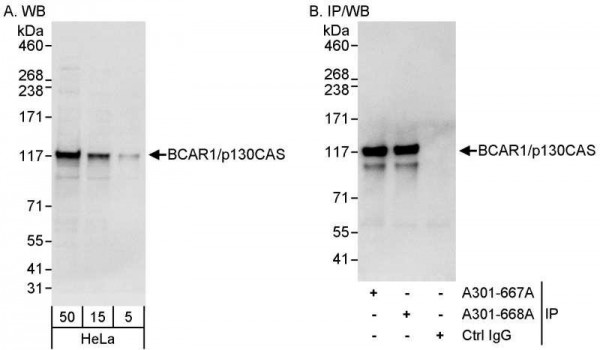 Anti-BCAR1/p130CAS