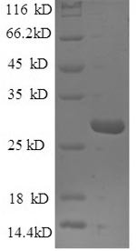 Mannose-binding protein C (MBL2), human, recombinant