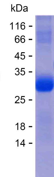 Alcohol Dehydrogenase/ADH1A (human), recombinant protein