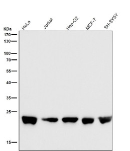 Anti-RALA / Ras-related protein Ral-A, clone 31R04