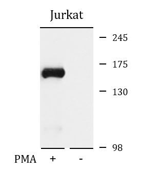 Anti-phospho-PLC gamma 1 (Ser1248)
