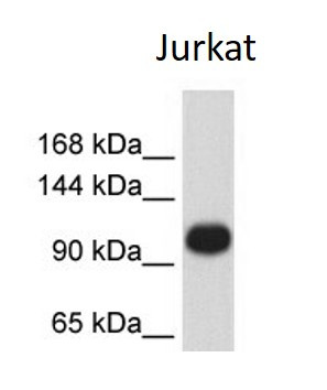 Anti-ATP2A3 / SERCA3 ATPase