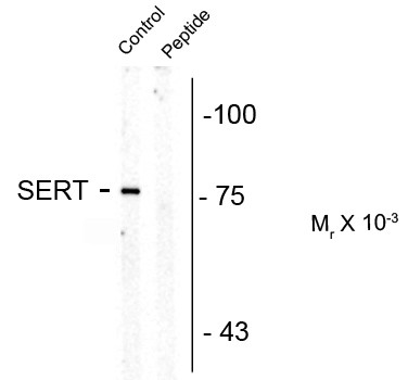 Anti-phospho-Serotonin Transporter (Thr 276)